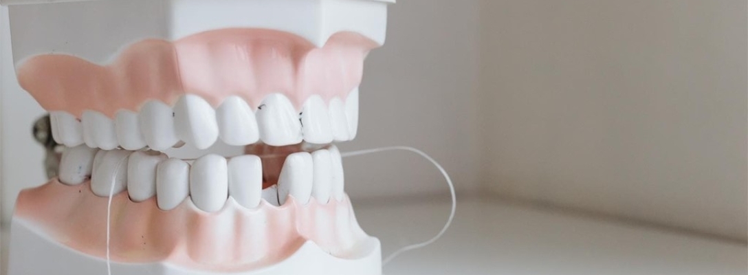 Consejos para cuidar los implantes dentales