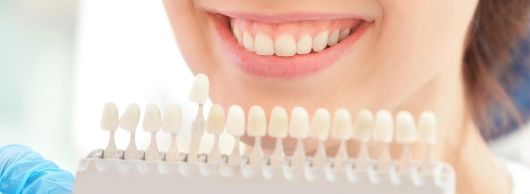Estética dental: tratamientos para mejorar la apariencia y salud de tu boca